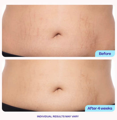 Tigther & Smother Belly Cream